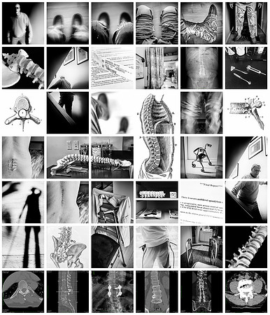 "Self-Portrait with Stenosis"