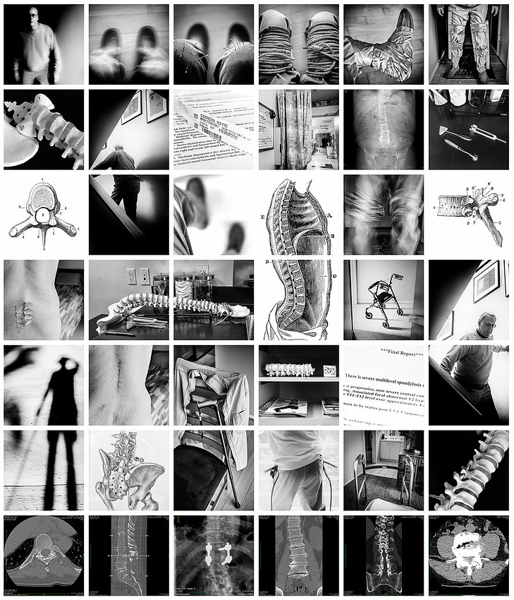 "Self-Portrait with Stenosis"