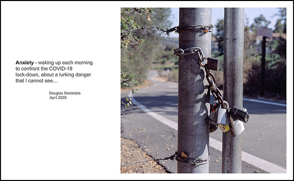 Douglas Stockdale "Anxiety"